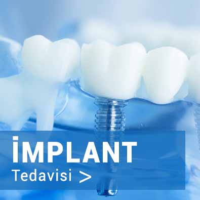 implanttedavisiı